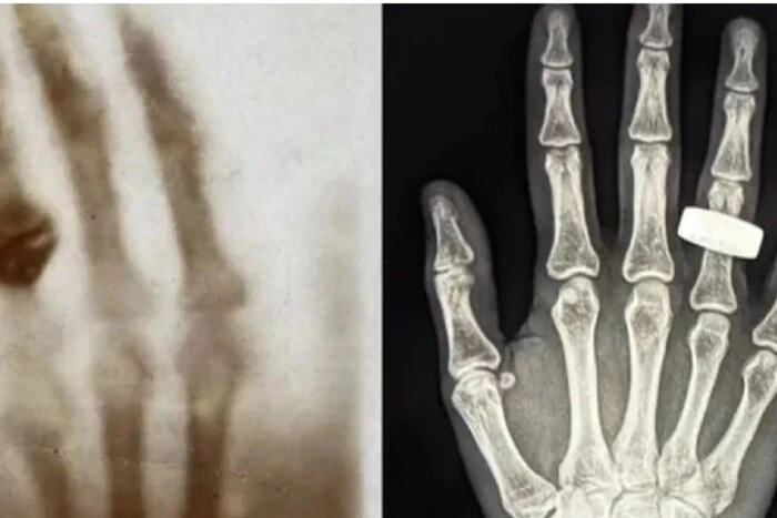 Astronaut in space on X-ray